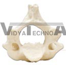 Axis cervical vertebrae model, (no stand)